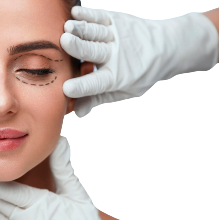 Blefaroplastia